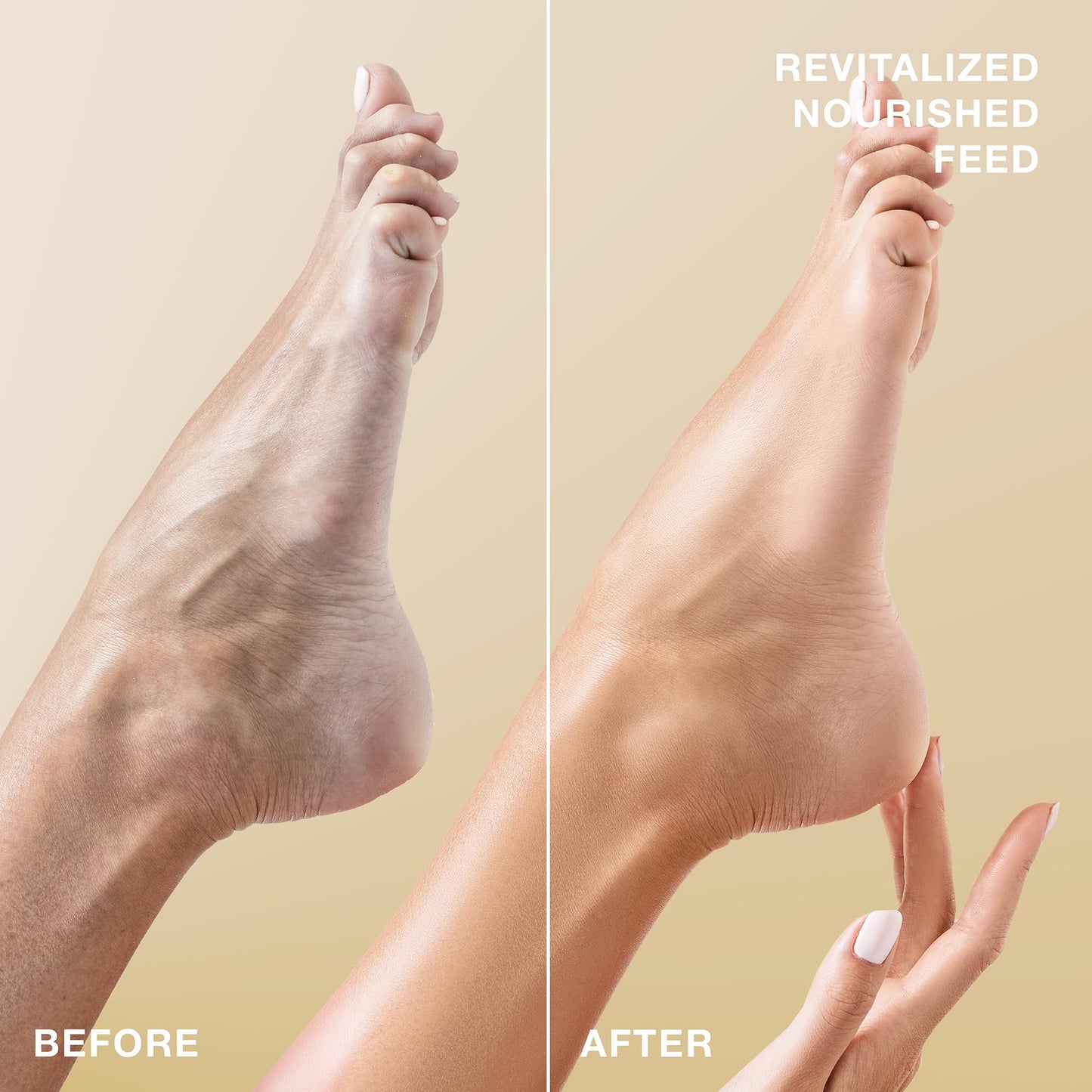 STARSKIN VIP Gold Mask Foot (1 Piece), Softening Foot Mask for all Skin Types, Korean Skin Care, Hydrating and Moisturizing with Shea Butter and Rose Oil
