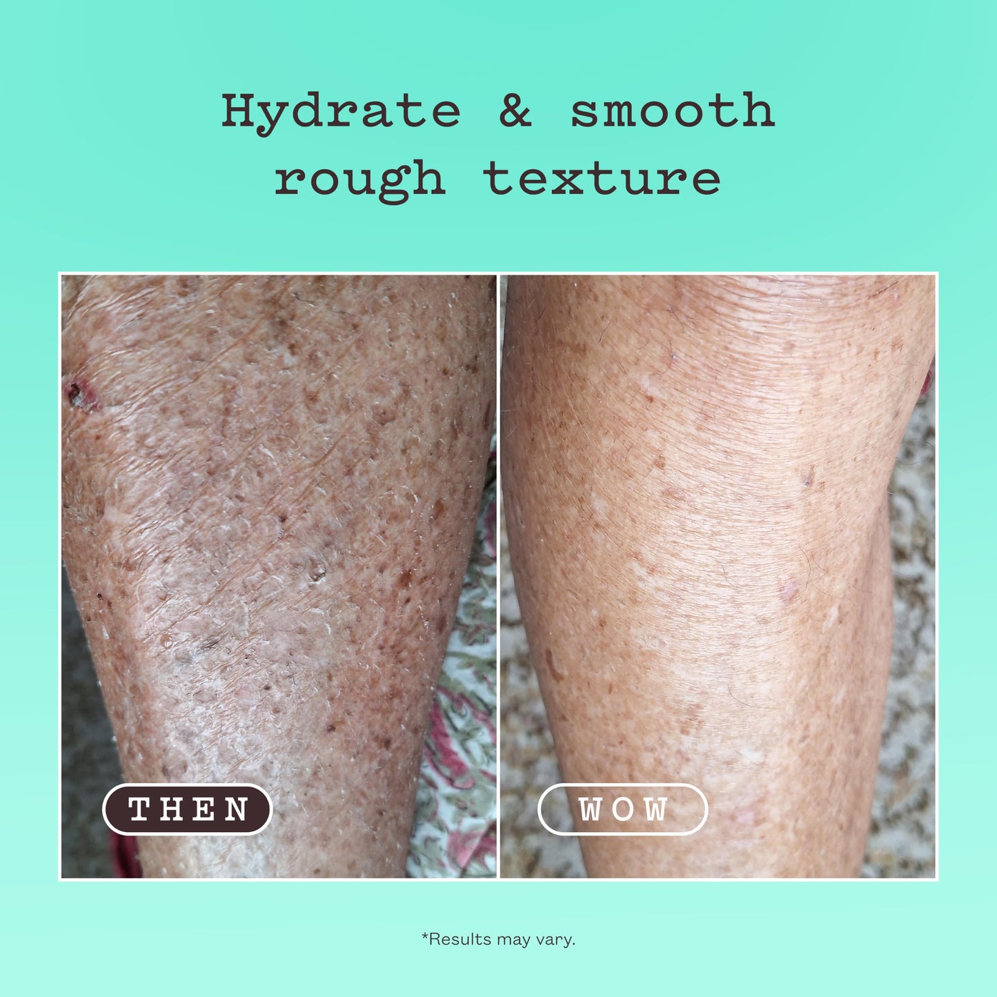 frank body Smoothing AHA Body Lotion | Gently Exfoliates to Smooth KP & Body Breakouts | With Lactic & Glycolic Acids, Hydrating Oils, Mango Seed Butter & Australian Botanicals | 140ml/4.73 fl oz