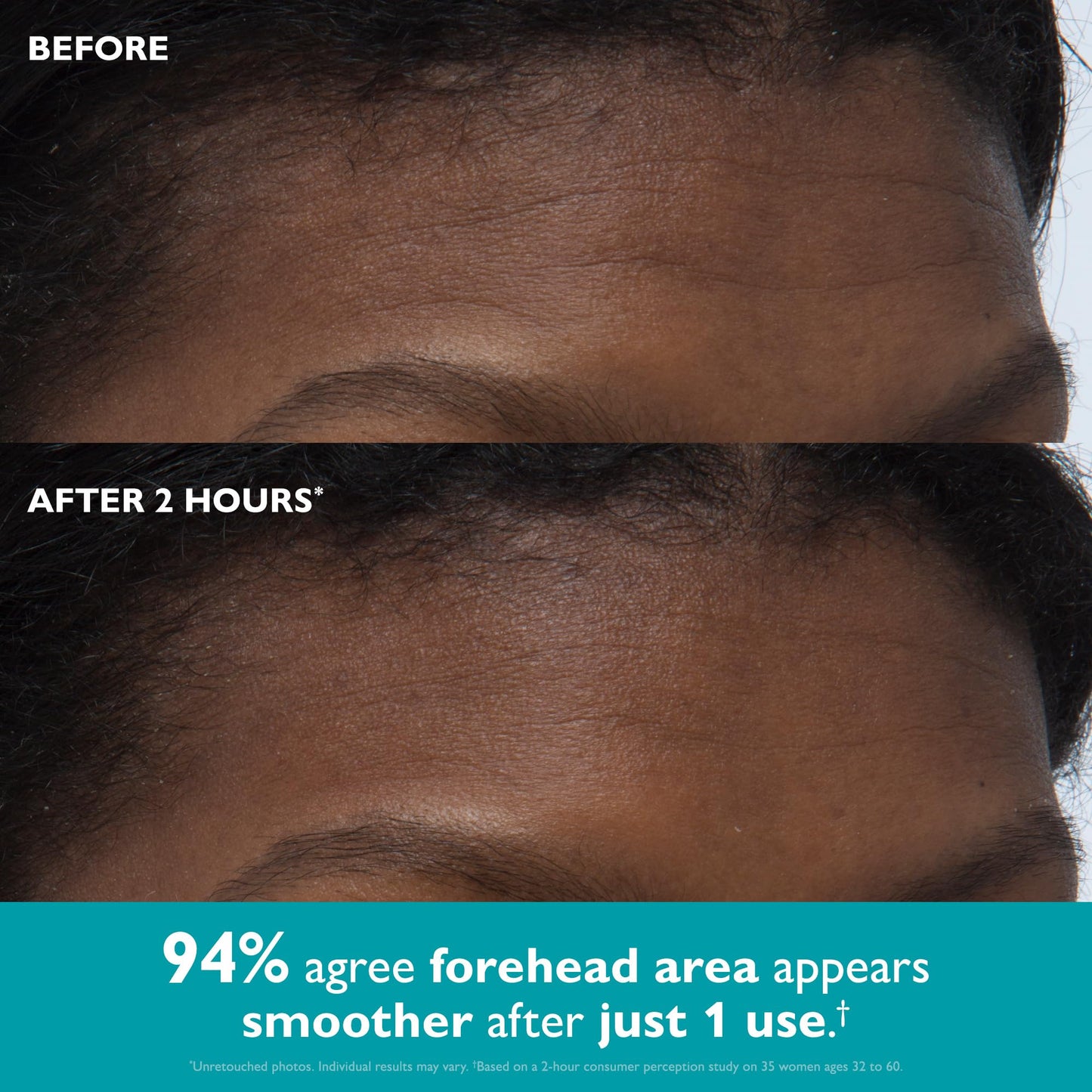 Peter Thomas Roth | Peptide Skinjection™ Peptide-Infused Face & Eye Tape | Face Tape For Wrinkles and Aging Skin | Peptide Face Tape