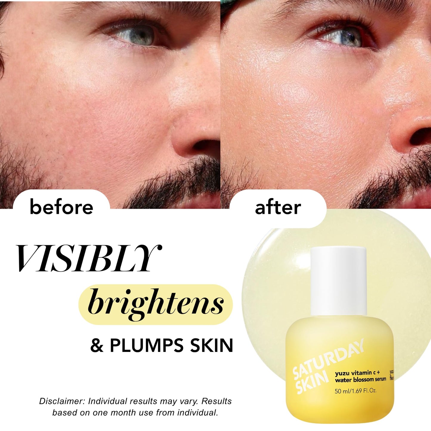 Saturday Skin Yuzu Vitamin C Serum for Face – Brightening Serum