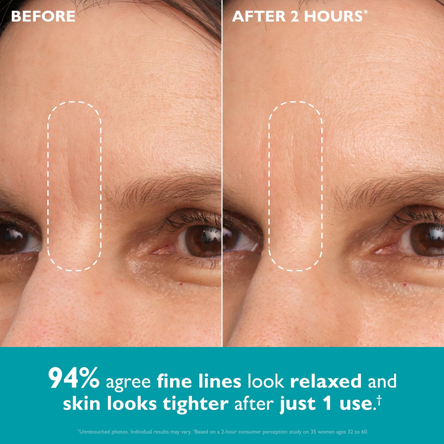 Peter Thomas Roth | Peptide Skinjection™ Peptide-Infused Face & Eye Tape | Face Tape For Wrinkles and Aging Skin | Peptide Face Tape
