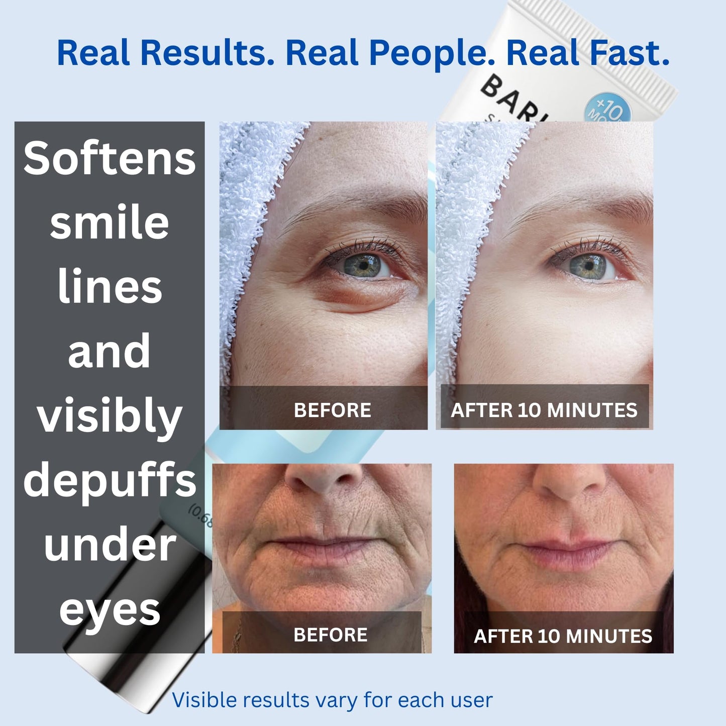 Barubit Rapid Reduction Eye Serum – Instant Eye Tightener for Under Eye Bags, Dark Circles & Fine Lines | Firming Under Eye Tightening Serum for Women & Men, Lasts 10–12 Hrs, 20ml
