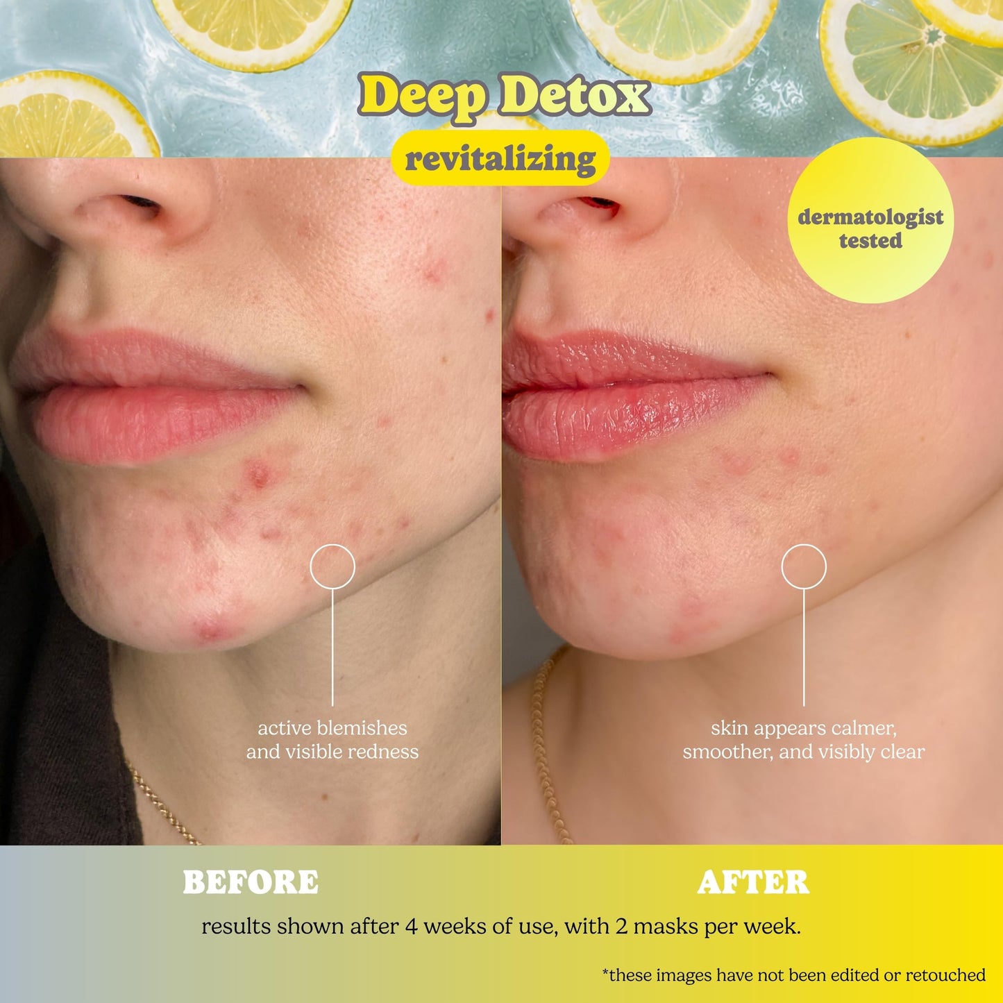ESW Beauty Deep Detox Clarifying Korean Face Mask – Vitamin C, Witch Hazel & Charcoal for Pores, Oil Control, Acne-Prone & Congested Skin – Skincare Gifts for Women