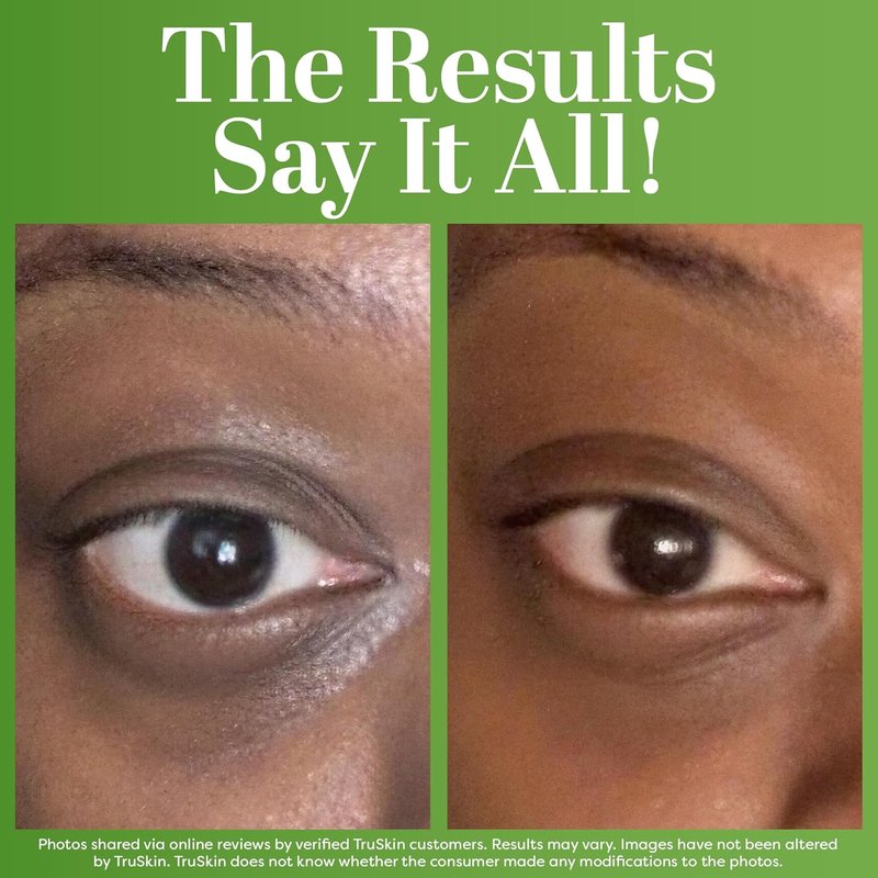 TruSkin Peptide Eye Cream Gel - Hydrating Under Eye Treatment for Dark Circles & Fine Lines | 0.5 Fl Oz