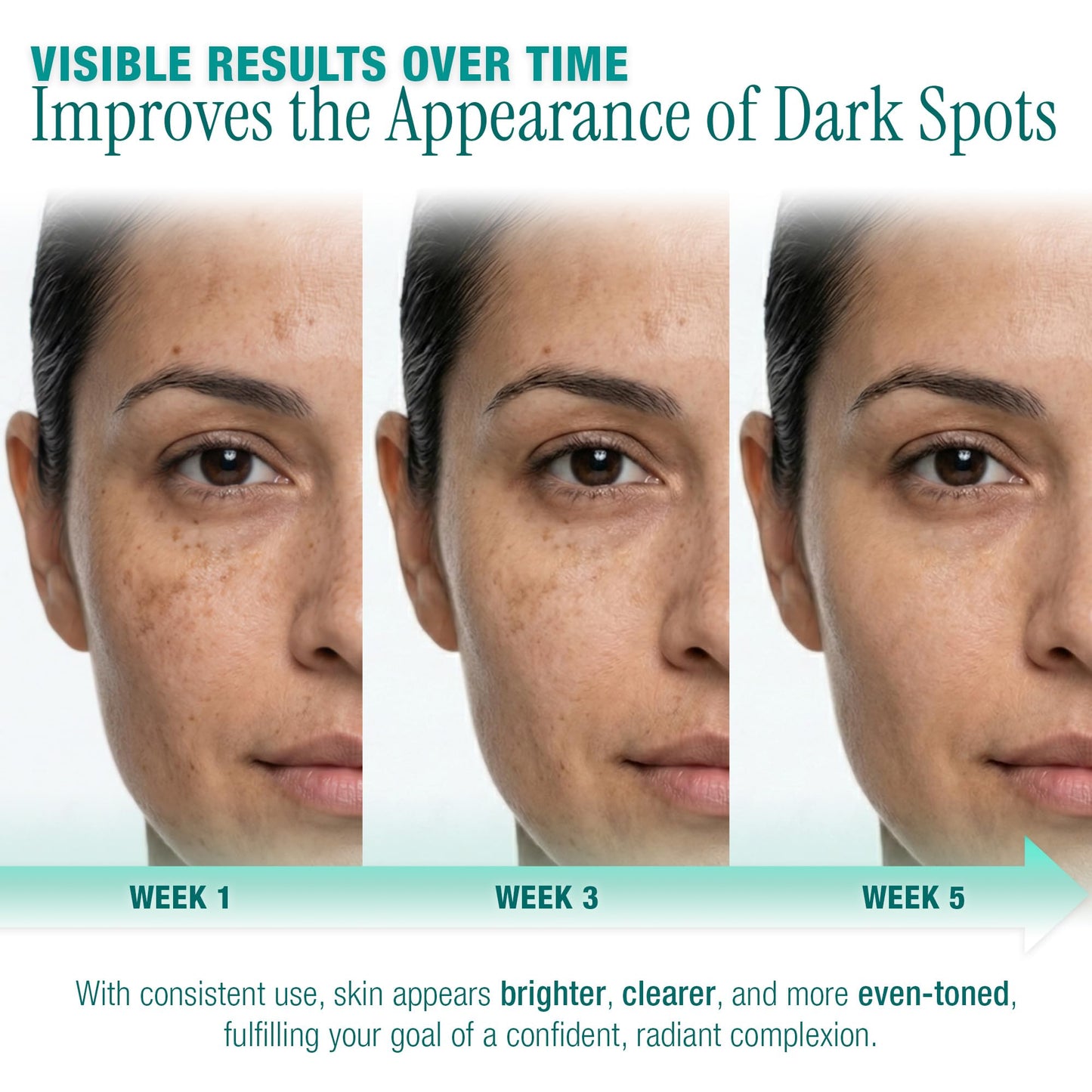 Ebanel Dark Spot Remover for Hyperpigmentation, Melasma and Age Spots