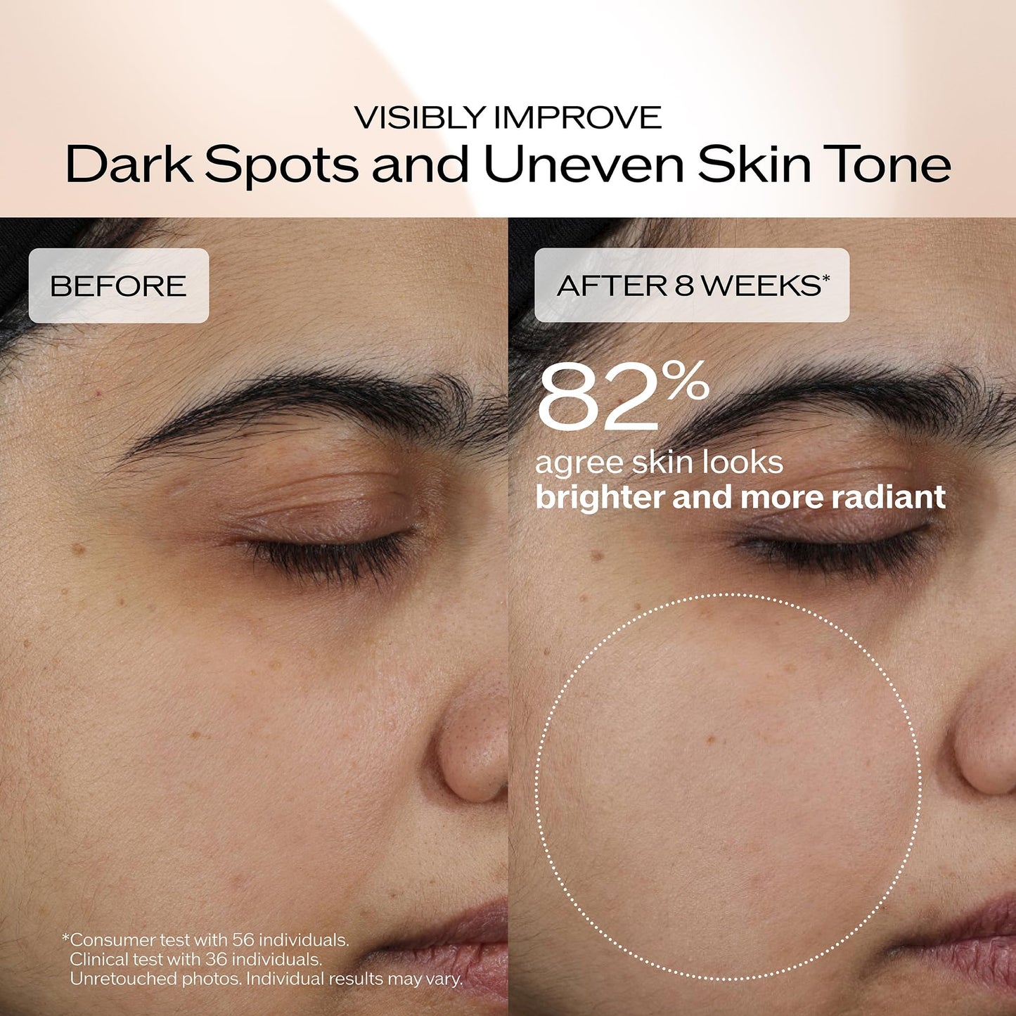 Shiseido Benefiance Brightening and Wrinkle Smoothing Cream Refill - 50 mL - Moisturizer Visibly Improves Dark Spots, Wrinkles with Plant-Based Retinol, 24HR Hydration, Non-Comedogenic, All Skin Types