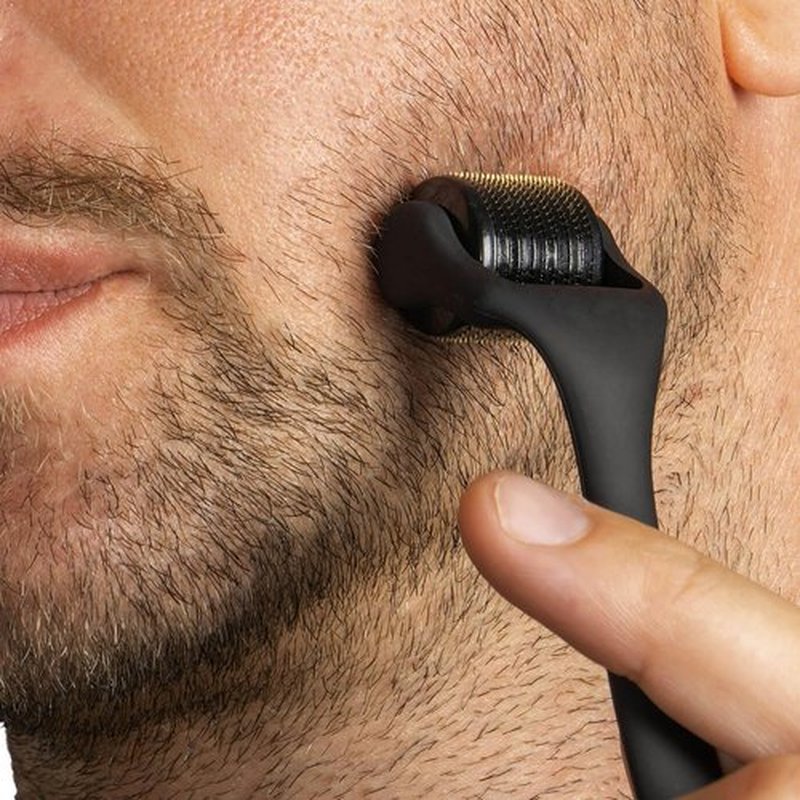 Angel Kiss Microneedling Derma Roller for Face, Body and Beard - 0.25mm Micro Needle Roller