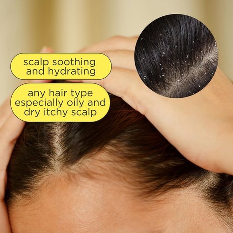 Pacifica Scalp Serum – Rosemary Mint Scalp Love Serum with Witch Hazel for Scalp Detox & Moisturizing, Vegan & Cruelty-Free, 2 oz