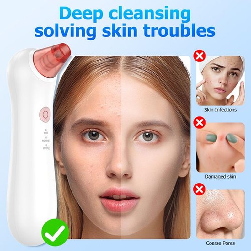 Blackhead Remover Pore Vacuum, Pore Extractor & Blackhead Removal Tools. Features 3 Adjustable Modes and 4 Probes for Removing blackheads, Whiteheads, and Acne. Deeply Cleans The Skin