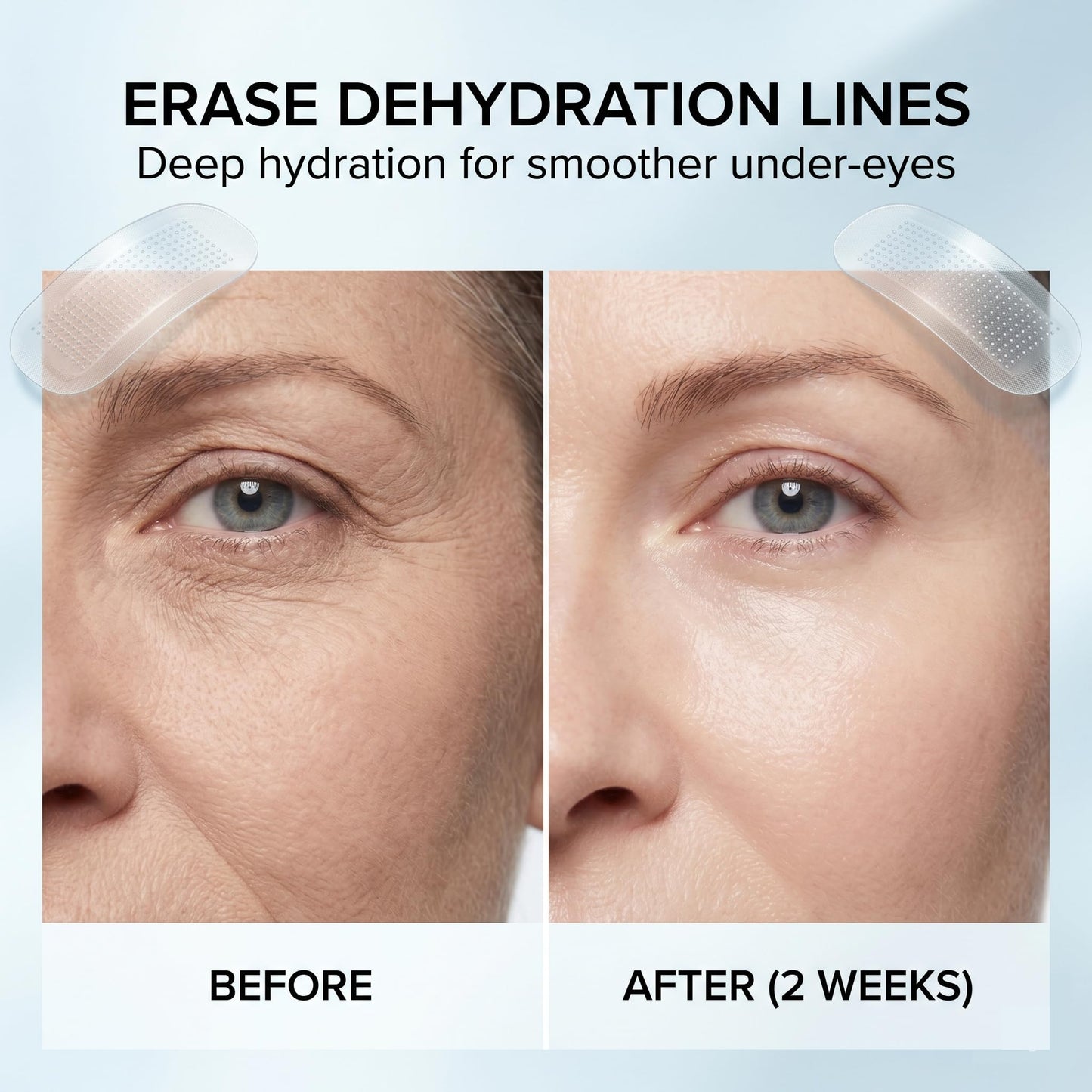 VILVIN Microdart Under Eye Patches for Face with Hyaluronic Acid and Tea Tree - Smile line Patch - Face Tape for Wrinkles - Wrinkle Patches for Face Overnight - Anti Wrinkle Patches