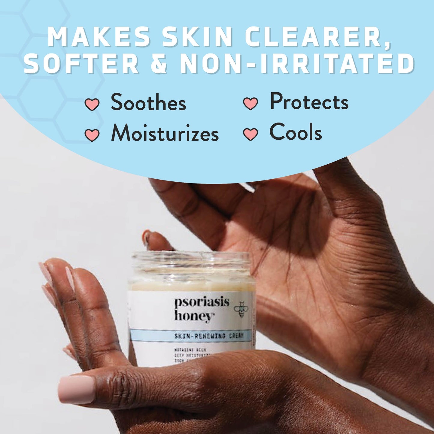 PSORIASIS HONEY Skin-Renewing Cream - Eczema & Seborrheic Dermatitis Cream - Psoriasis Treatment for Skin, Redness & Itch Relief (4oz)