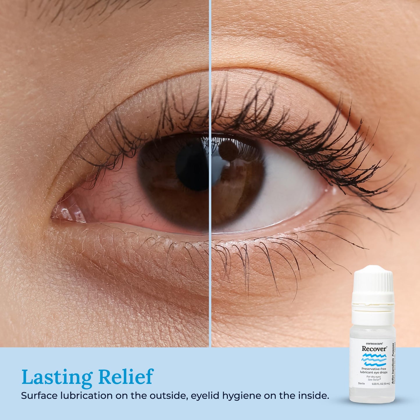 CorneaCare Recover: Eye Drops | Preservative Free Artificial Tears | Hydrating Eye Drops for Dry Eye Relief & Redness | Multi-dose Bottle (300 Drops)