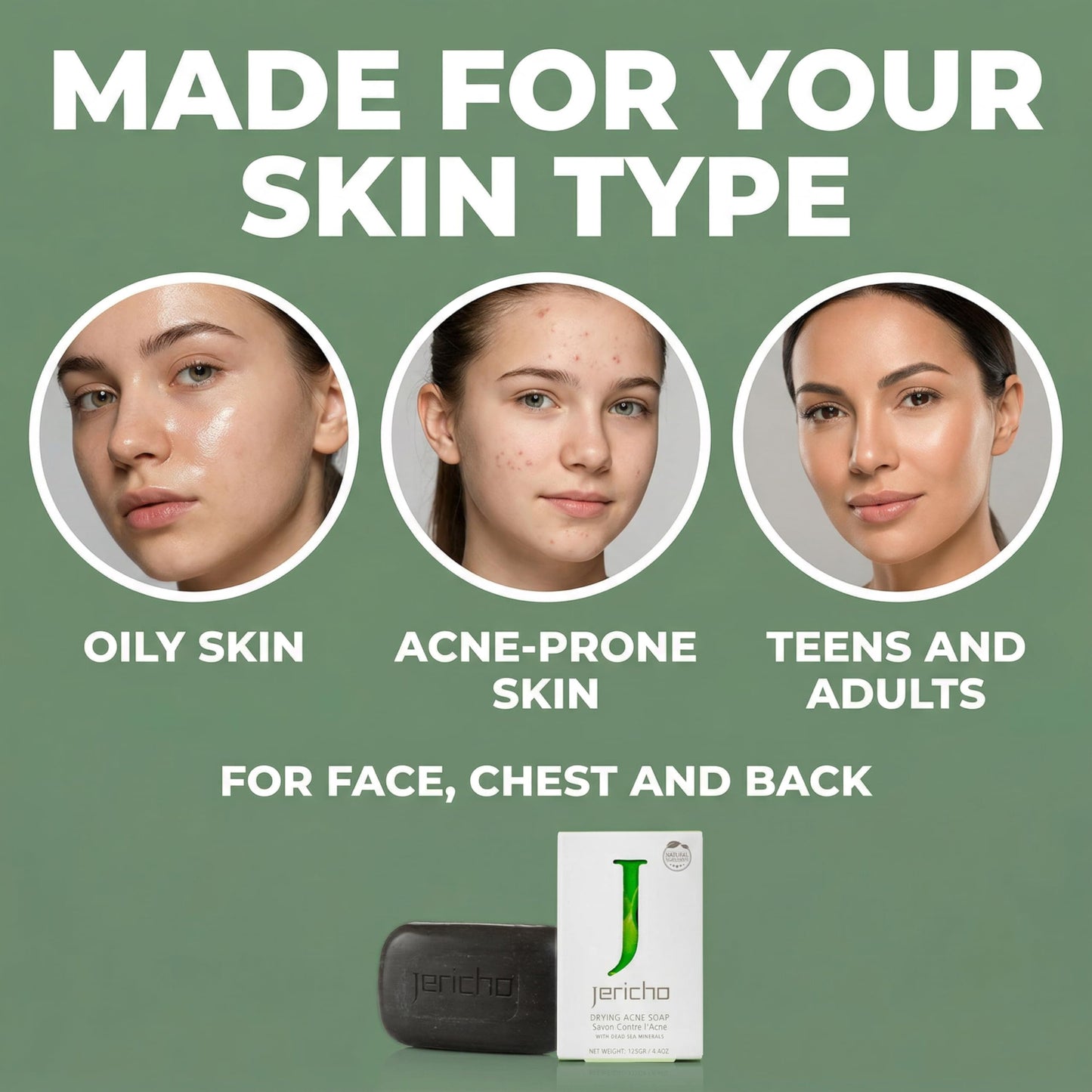 Jericho Acne Drying Bar Soap Face, Chest & Back – Dead Sea Mineral Cleansing Bar, Oily Acne-Prone Skin – Deep Pore Cleanser, Breakouts, Blackheads – Teens & Adults 4.4oz / 125g