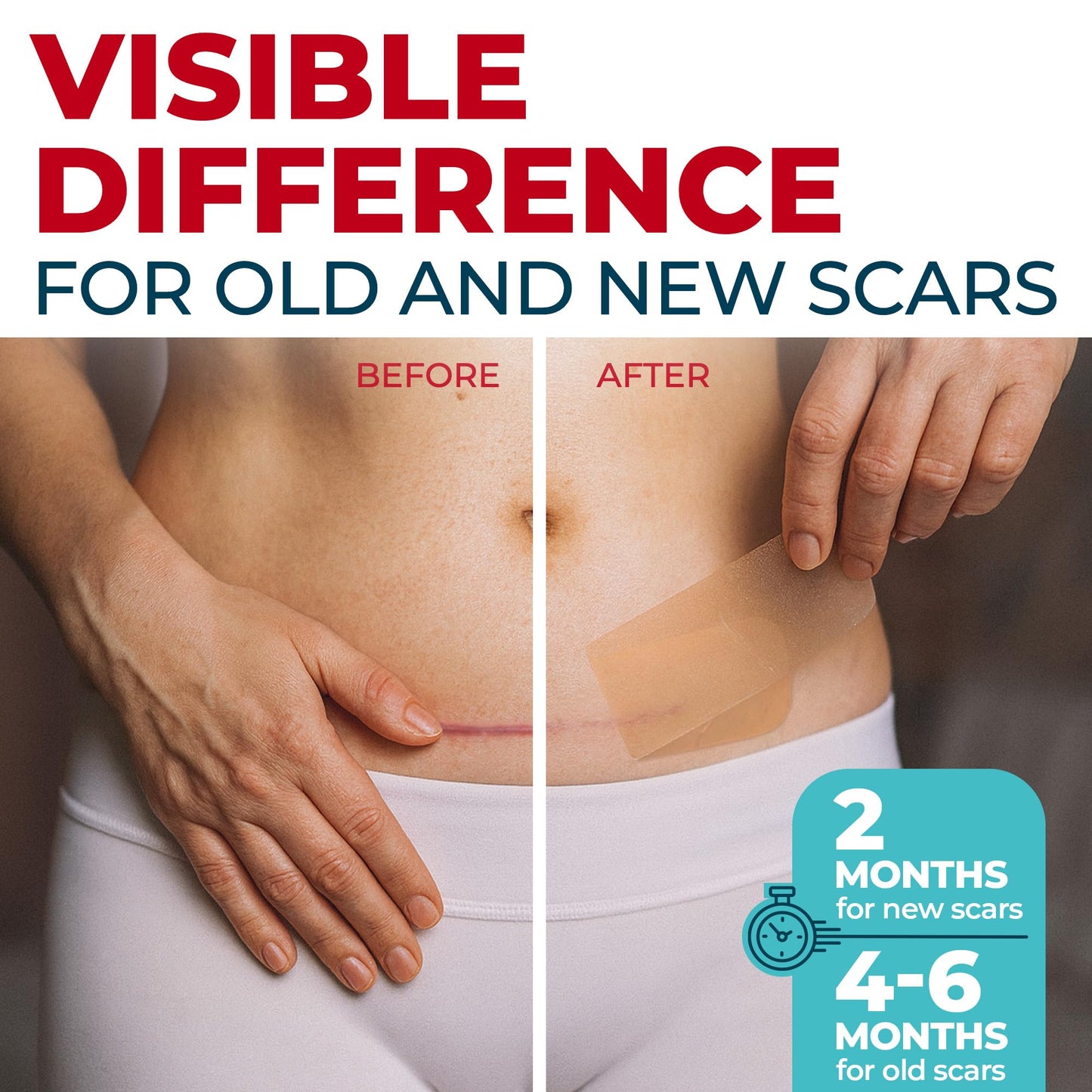 Medical Grade Silicone Scar Tape - 1.6”x60” - Visible Difference on Surgical & Keloid Scars - Reusable Silicone Scar Sheets - Easy to Use Silicone Tape for Scars