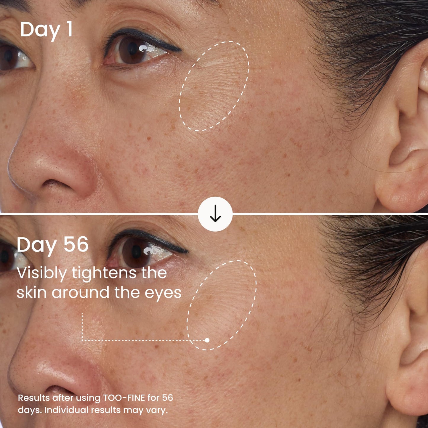 MAËLYS TOO-FINE Firming Anti-Aging Face Serum - Instantly Lifted Look - Glaucine & Bacillus Ferment - Face Tightening Serum Helps Lift Look of Sagging Skin on Jawline, Cheekbones & Under Eyes (15 mL)