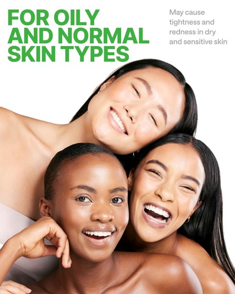 WONDER FAMILY Korean Carbonated Bubble Clay Mask for Face – Black Head Remover for Face – Deep Pore Cleansing Mask – Facial Blackhead Remover Mask – Pack 7 Korean Face Masks Skincare