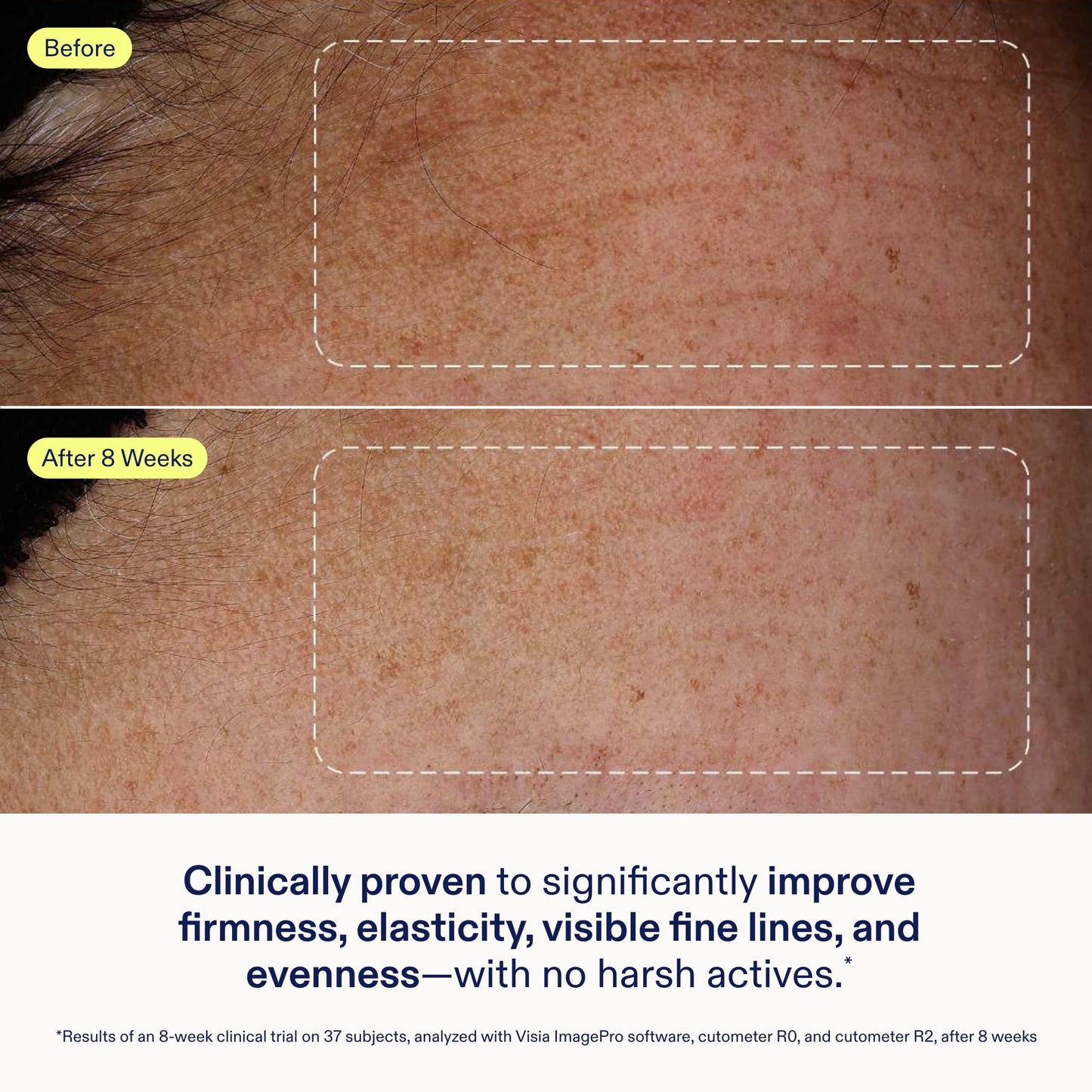 Skinfix Exo + Ectoin Intensive Repair Baume - 1 oz - Retinol-Free Face Serum with Hyaluronic Acid, Peptides - Visibly Smooths Wrinkles, Evens Dark Spots & Redness - Fragrance Free, Vegan, Cruelty Free