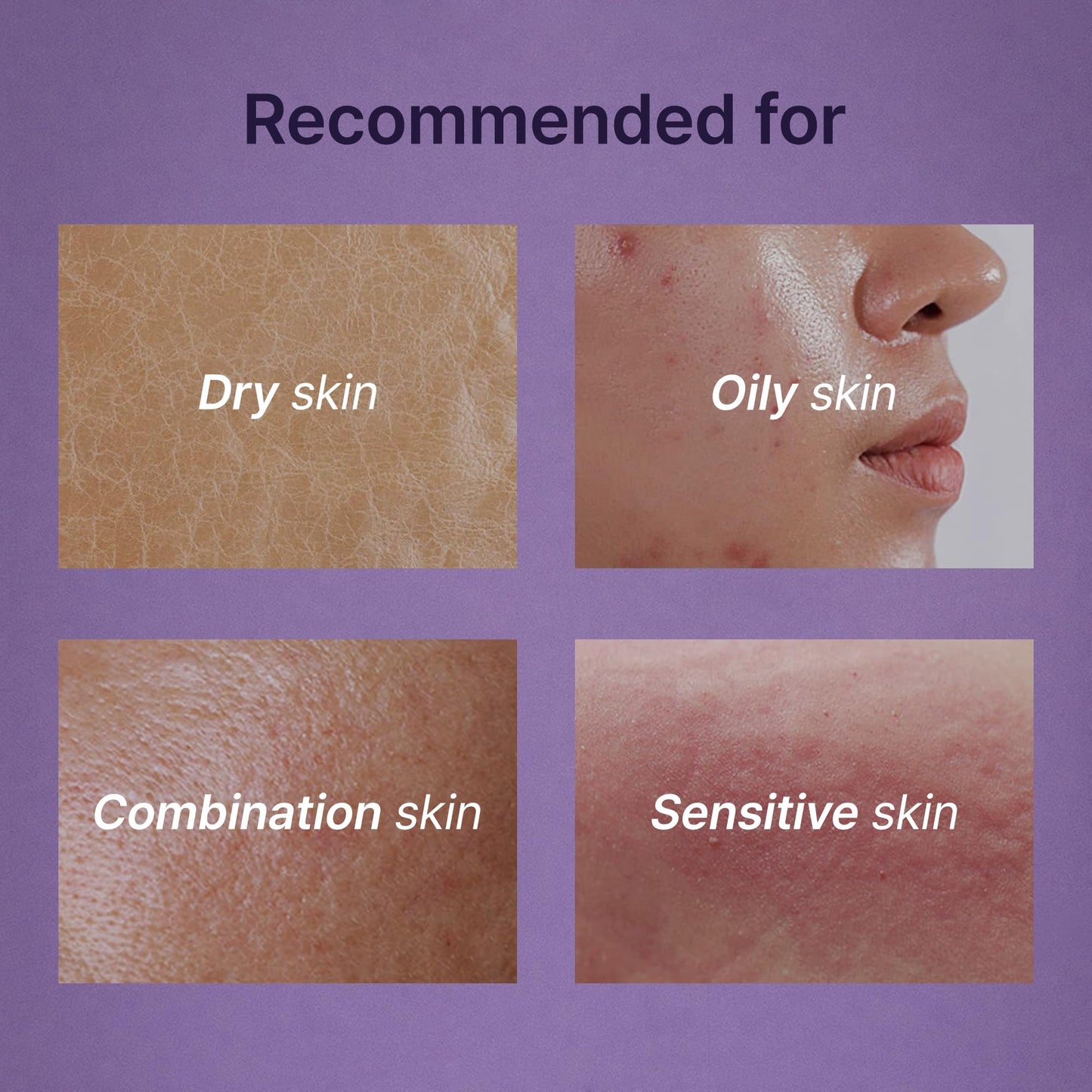 TROIAREUKE ACSEN Oil Cut Cleansing (10.14 Fl. Oz.), Oil-free, Hypersensitivity, Acne-prone and sensitive skin, Damaged skin, Oily skin, Cleansing gel, Sebum balancing, Make-up remover, Facial cleanser