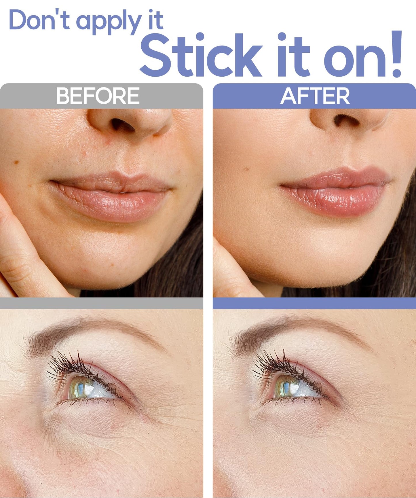 VILVIN Microdart Under Eye Patches for Face with Hyaluronic Acid and Tea Tree - Smile line Patch - Face Tape for Wrinkles - Wrinkle Patches for Face Overnight - Anti Wrinkle Patches