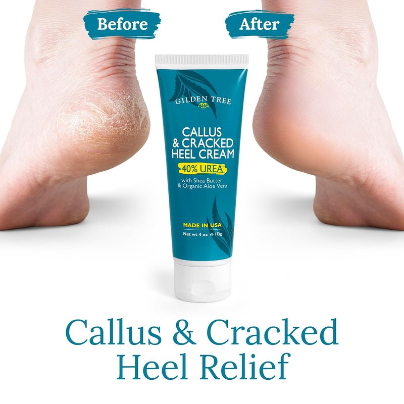 Urea Cream 40% - Maximum Strength Cracked Heel Treatment | Moisturizing Foot Cream with Shea Butter & Aloe for Dry Feet