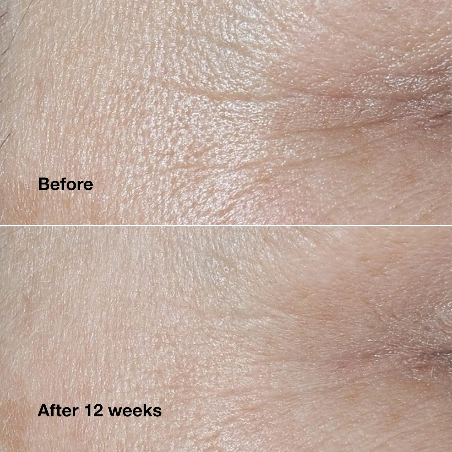 Clinique Smart Duo - Smart Clinical Repair Wrinkle Correcting Anti Aging Face Cream + Smart Clinical Repair Wrinkle Correcting Anti Aging Face Serum