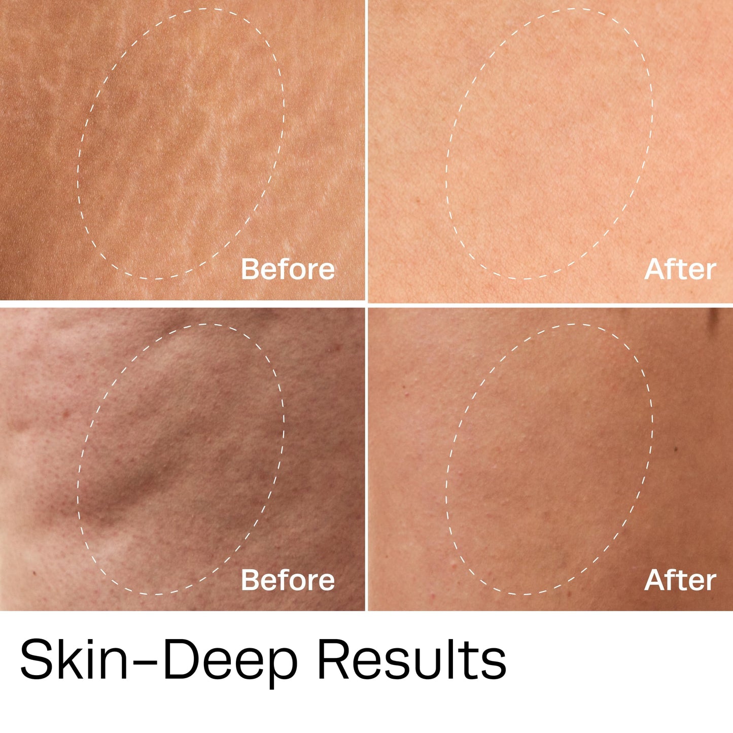 Hot Vita Vitamin C Oil, Body Oil After Shower for Dry Dull Skin, Lightweight Cellulite Oil for Daily Massage, Smooth-Looking Skin, Soft Moisture, and Healthy Body Glow