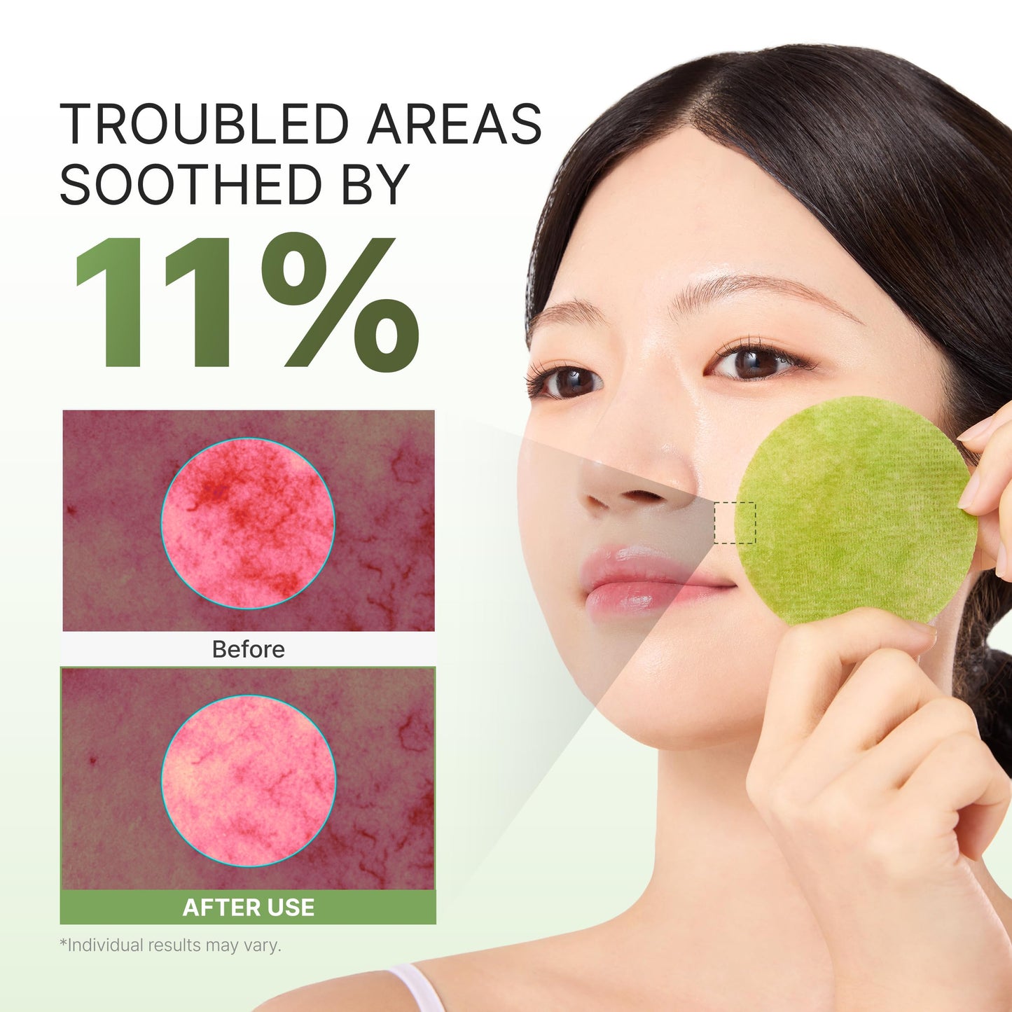 P.CALM Azelaic Acid Matcha 1000 Gauze Gel Toner Pad | Azelaic Acid & Matcha for Daily Resurfacing, Skin Soothing & Hydration, Gentle Exfoliating Toner Pads | Korean Skincare, 110g / 3.88 oz, 60 Pads
