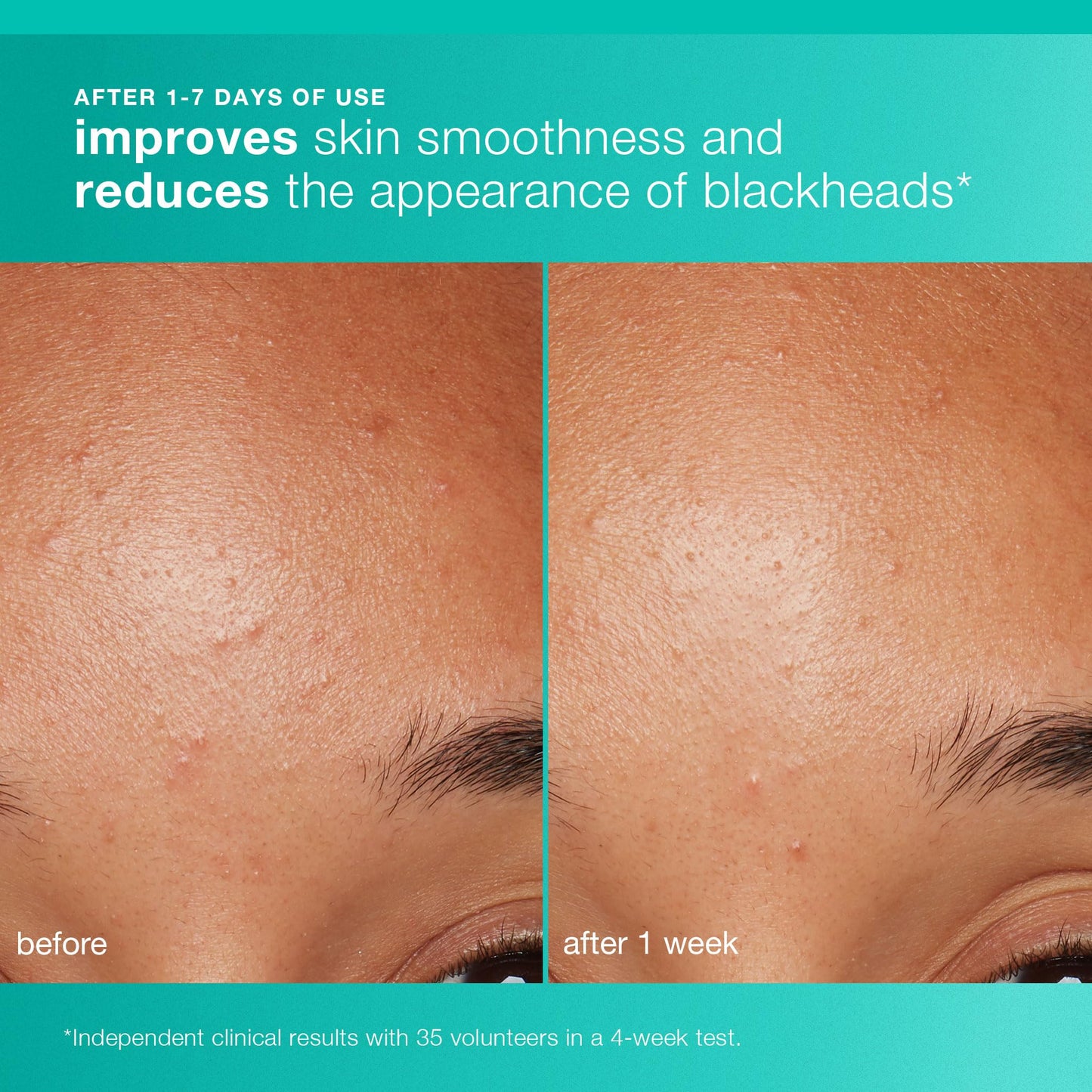 Dermalogica Clear and Brighten Kit, Travel Size