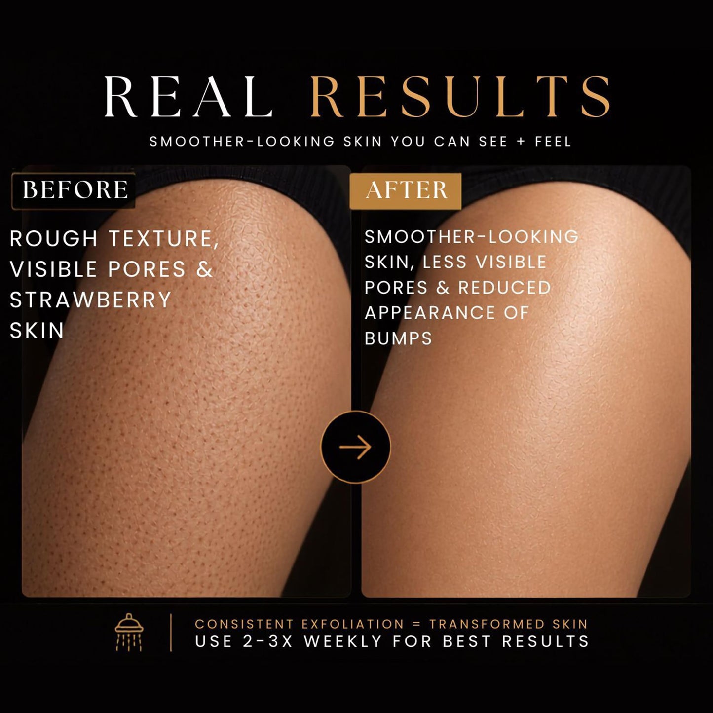 Intimate Luxe Exfoliating Mitt – Reusable Physical Exfoliating Glove for Smooth-Looking Skin – Helps Lift Dead Skin & Surface Buildup – Shower & Bath Use – Single Mitt