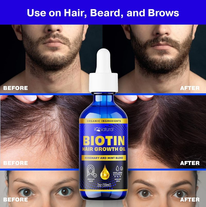 IQ Natural Hair Growth Serum - Organic Biotin & Rosemary Oil for Thicker Hair | 2oz