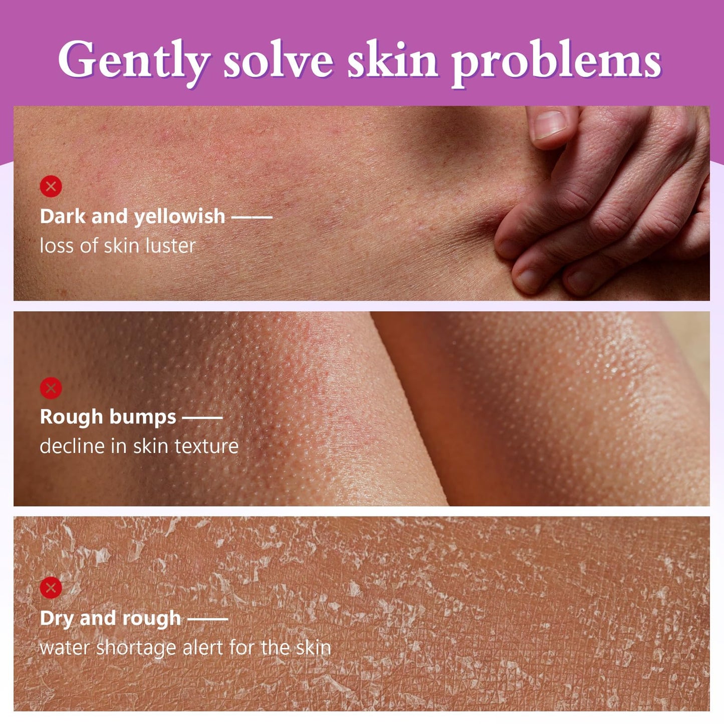 Glycolic Acid Body Scrub Stick for Rough & Bumpy Skin - 7% AHA + 0.5% BHA Exfoliating Stick with Shea Butter, Gentle Chemical Exfoliator for Arms, Legs, Back, 2.65oz for Men & Women