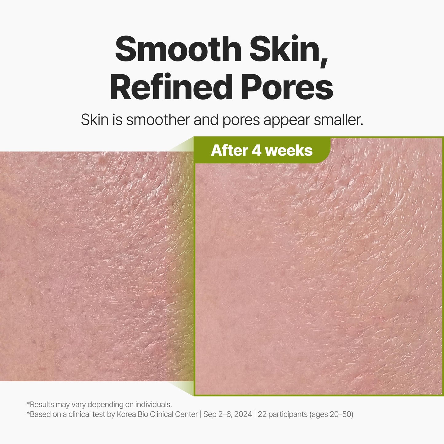 P.CALM Holy Basil Bubble Deep Mask + Brush | Pore Reset with Holy Basil, Blackhead Care & Excess Oil Control, Bubbling Clay Wash-Off Mask | Korean Skincare, 90g / 3.17 oz