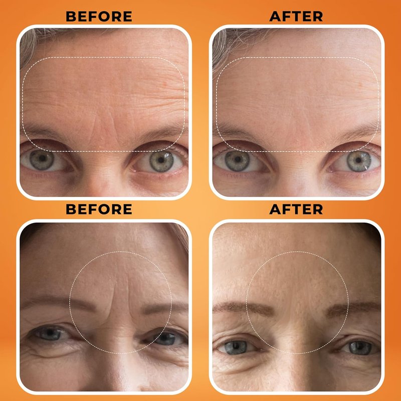 Deep Wrinkle Filler Cream - Collagen-Infused with Birch Sap, Jojoba & Avocado | 1.3 fl oz for All Skin Types
