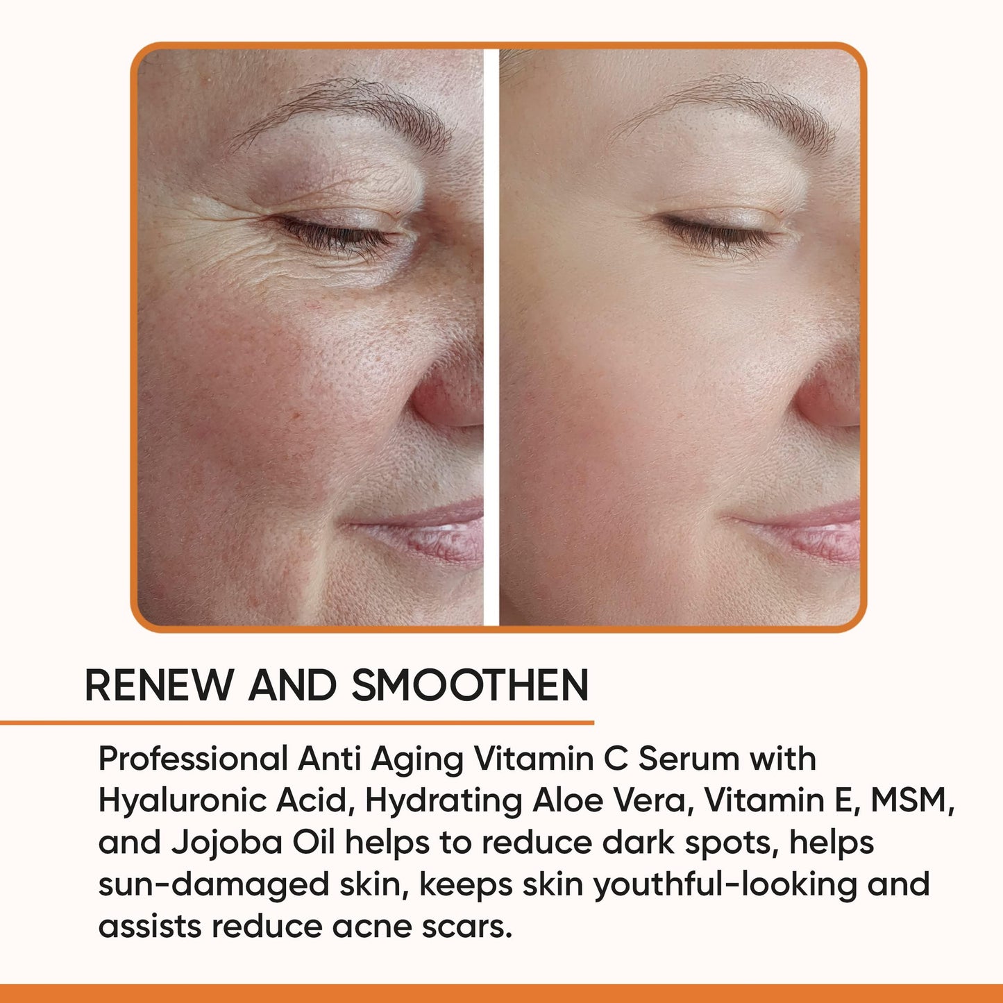 100% PURE VITAMIN C SERUM FOR FACE, Anti Aging Serum with Hyaluronic Acid, Vitamin E, MSM, Hydrating Serum for Dark Spots, Fine Lines, Wrinkles, Organic Vegan Ingredients - DOUBLE SIZED (2 OZ)