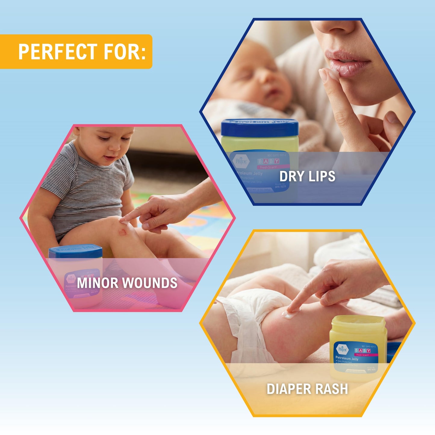 MED PRIDE Petroleum Jelly, Fresh Baby Scent, Baby Blue, Protectant, 13 oz