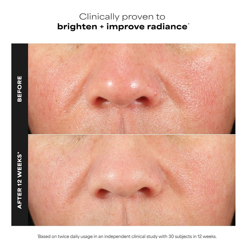 Paula's Choice BOOST C15 Super Booster - 15% Vitamin C Serum for Radiant Skin | Fragrance-Free, with Vitamin E & Ferulic Acid