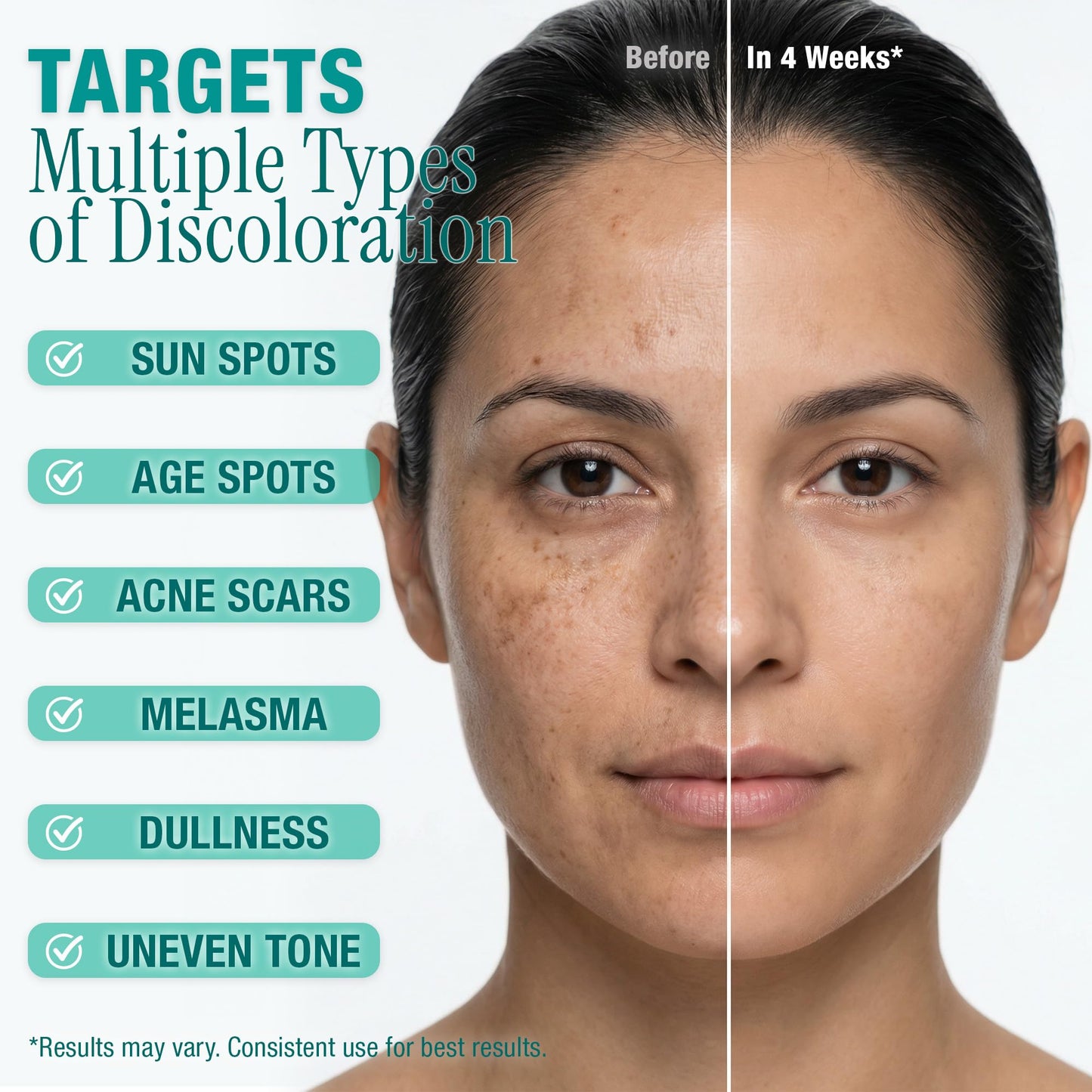 Ebanel Dark Spot Remover for Hyperpigmentation, Melasma and Age Spots