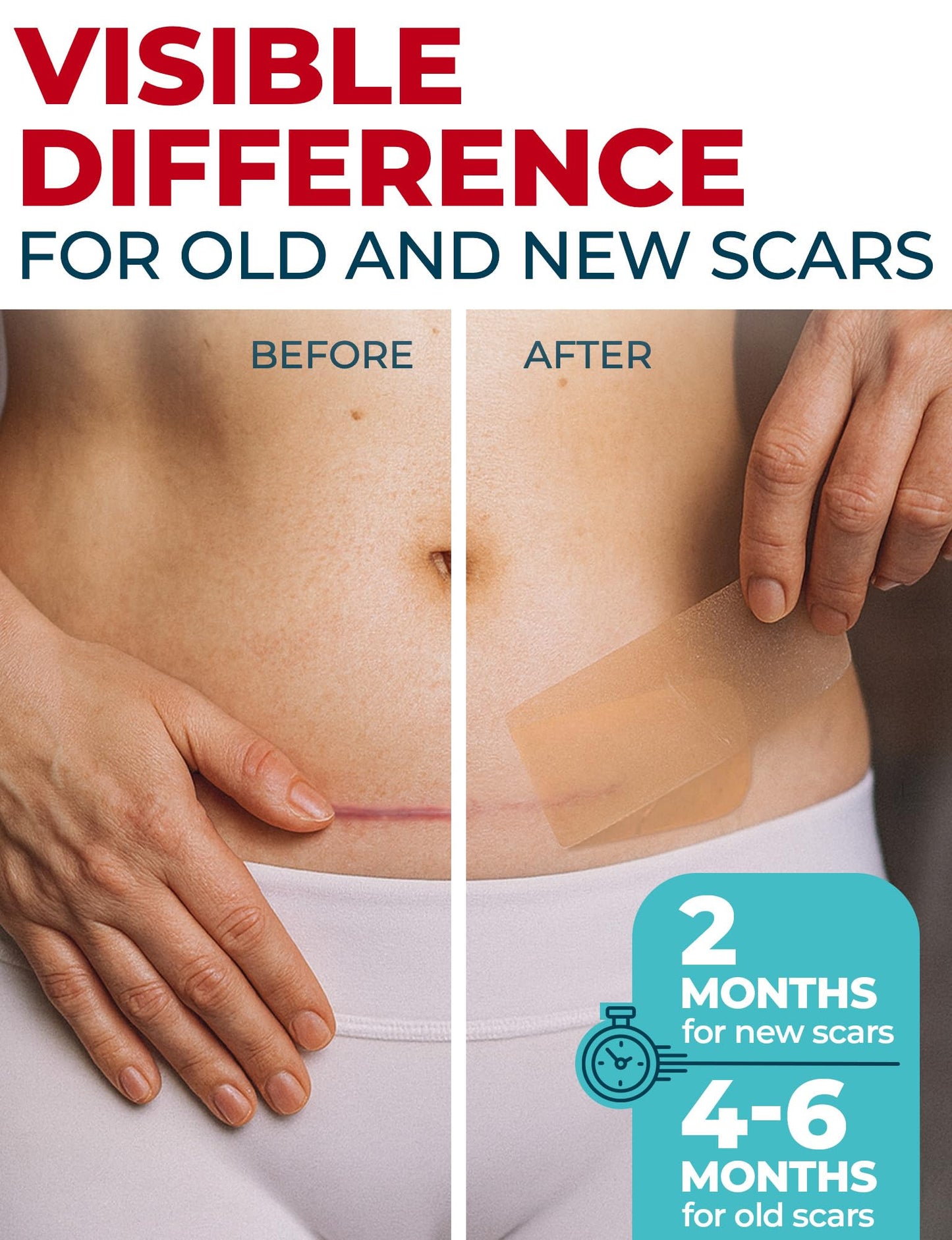 Medical Grade Silicone Scar Tape - 1.6”x120” - Visible Difference on Surgical & Keloid Scars - Reusable Silicone Scar Sheets - Easy to Use Silicone Tape for Scars