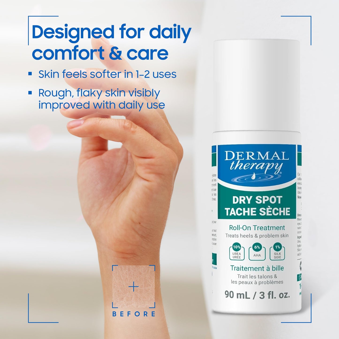 Dermal Therapy Dry Spot Treatment Roll-On with 10% Urea & 6% AHAs – Hydrating & Exfoliating Care for Very Dry Skin on Feet, Heels, Elbows & More – Fragrance-Free, Hands-Free Application