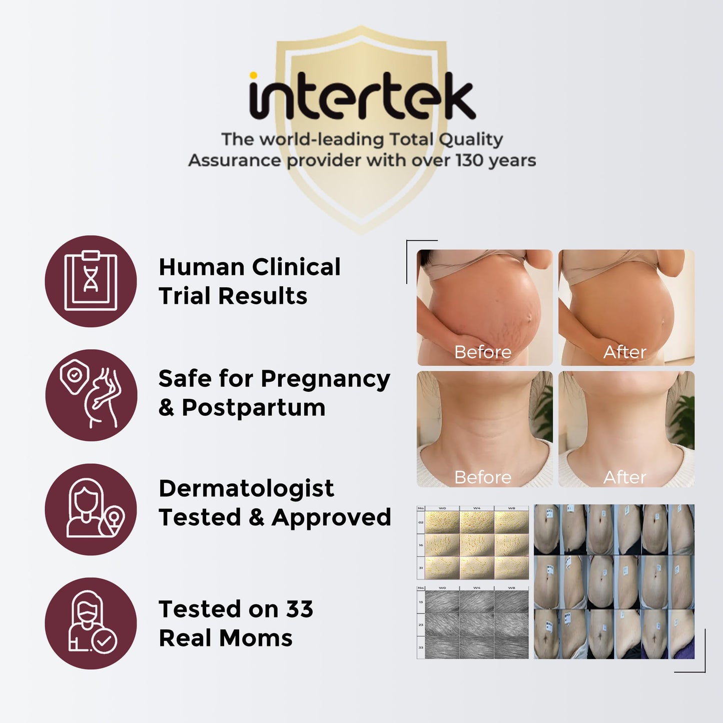 Momcozy Oil Capsule Cream for Stretch Marks, Sample Duo, EWG Verified, Clinically Tested, Non-Greasy, Safe for Pregnancy & Sensitive Skin, 0.36 oz (2 x 5g Sachets)