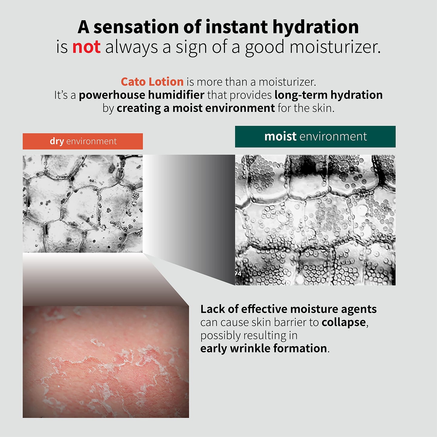 PCALM Cato Barrier Super Calming Ceramide Facial Lotion 6.76 Oz Unscented Not Greasy Soothing Hydrating Moisturizer for All Skin Types Acne-Prone Sensitive Dry Oily Combination Hypoallergenic Korean