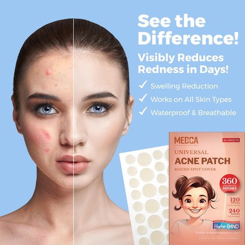 Acne Patches for Face - Hydrocolloid Bandages (360 Count) Pimple Patches for Face in 2 Universal Sizes, Acne Spot Treatment Care for Face & Skin Spot Patch Conceals Zits, Acne and Blackheads