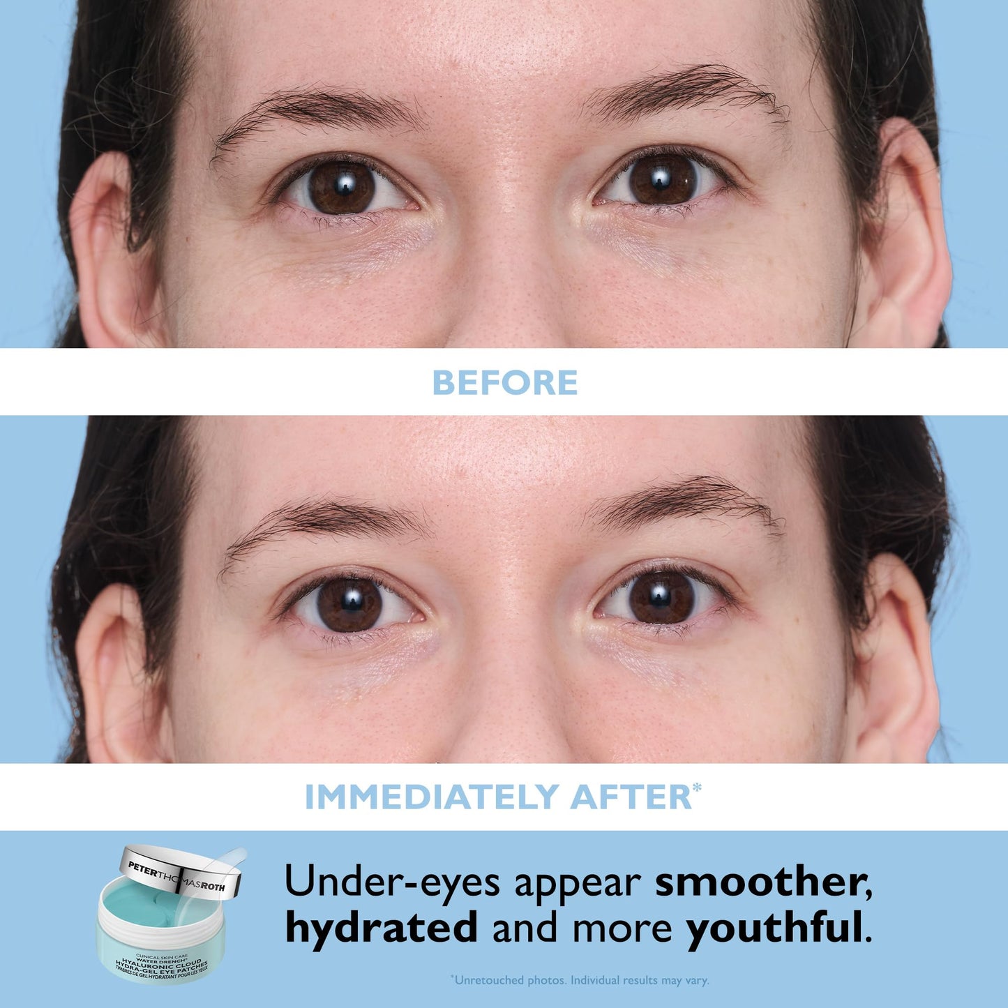 Peter Thomas Roth Women's Full-Size Vitamin C & Hyaluronic Eye Patches 2-Piece Kit
