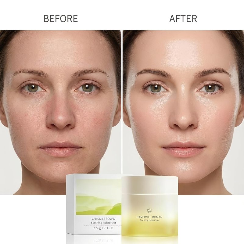Chamomile Roman Soothing Face Moisturizer Cream - Hydrating Daily Cream for Dry, Oily & Sensitive Skin | 1.7 fl. oz.