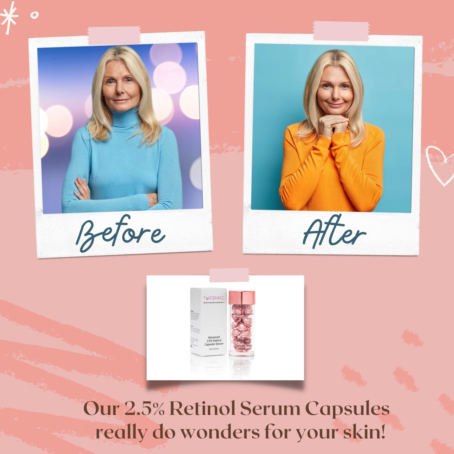 Turbinne Pure 2.5% Retinol Serum Capsules. Look 5 Years Younger In 30 Days. Powerful Anti -Aging, Deep Hydration, Brightening, Reduce Acne, Dark Spots & Wrinkles (30 Count)