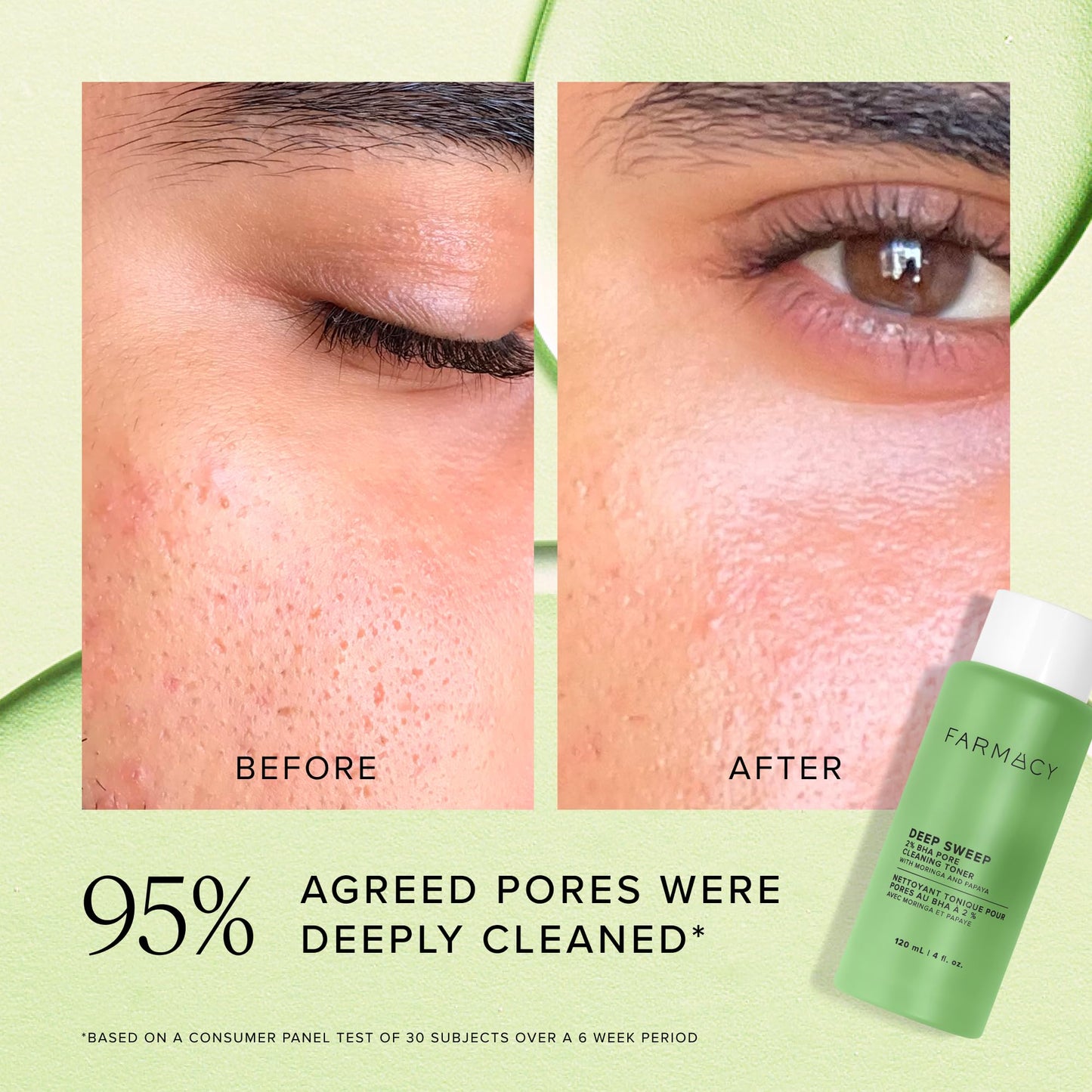 Farmacy 2% Salicylic Acid Toner for Face - Deep Sweep BHA Liquid Exfoliant + Pore Cleaner - Controls Oil, Gently Exfoliates + Refines Pores - Skin Care for Combo, Oily + Blemish-Prone Skin - (10ml)