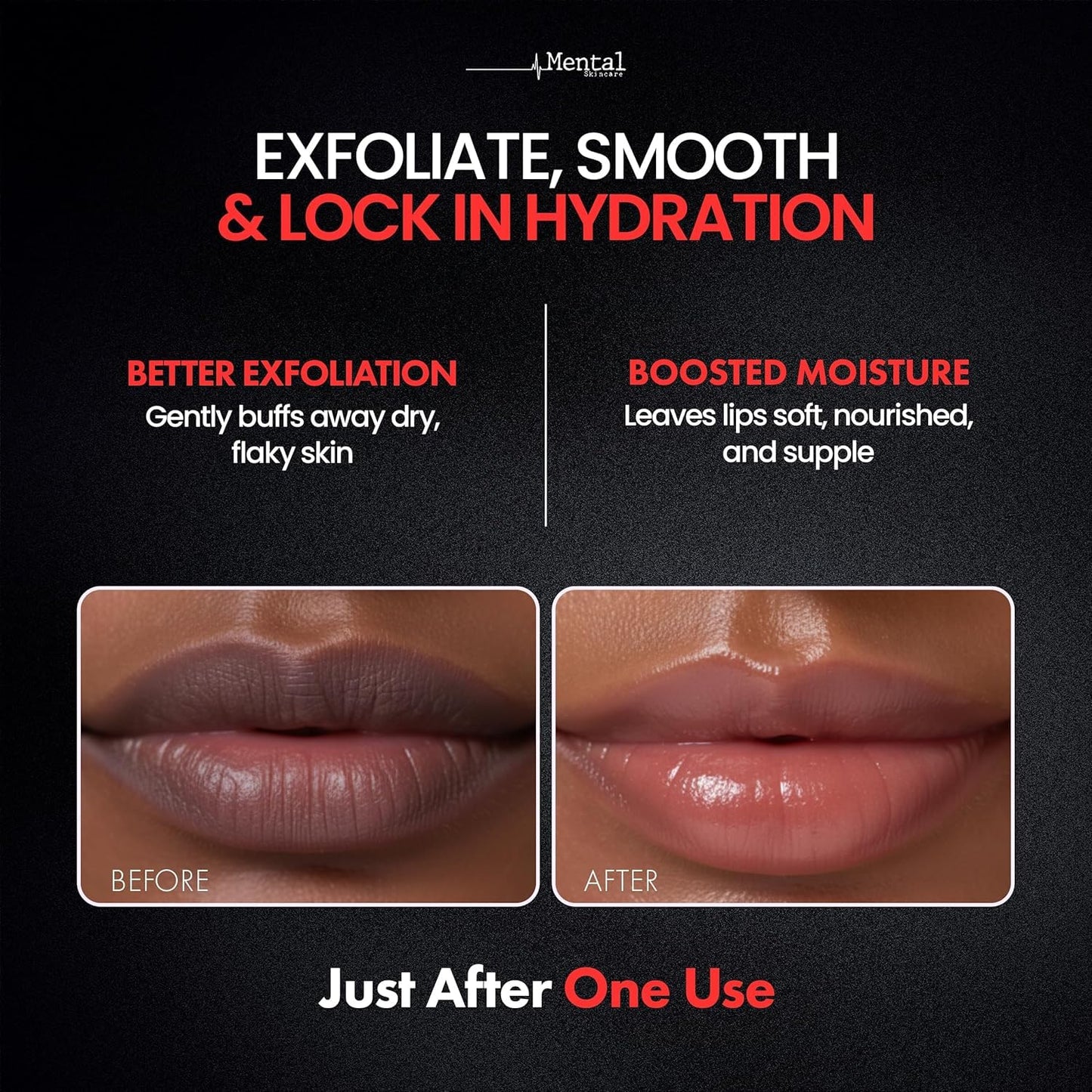 Coconut Sugar Lip Scrub – Gentle Exfoliator for Dark, Dry & Chapped Lips