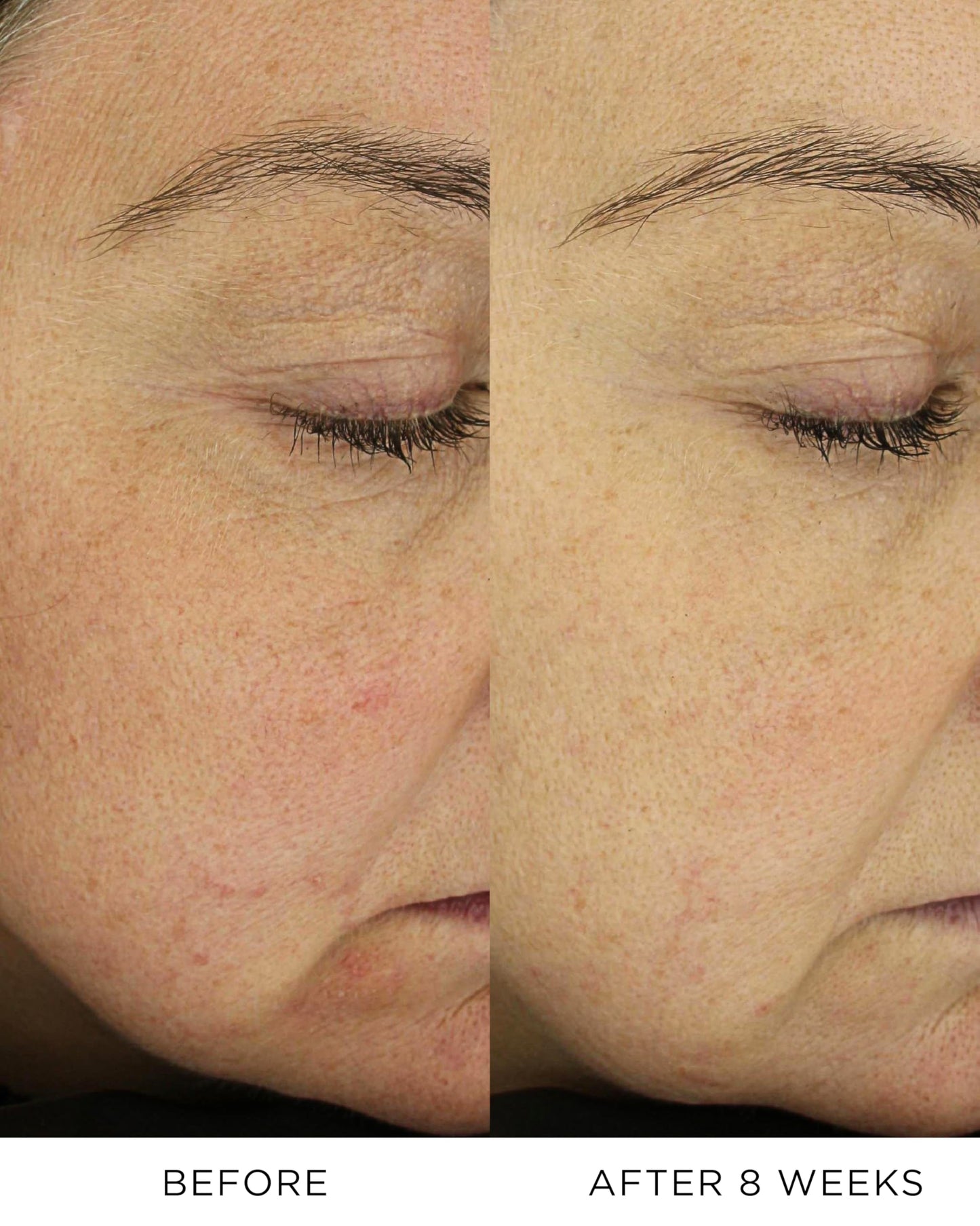 The Absolute Nourishing Lift Oil, 30 Doses