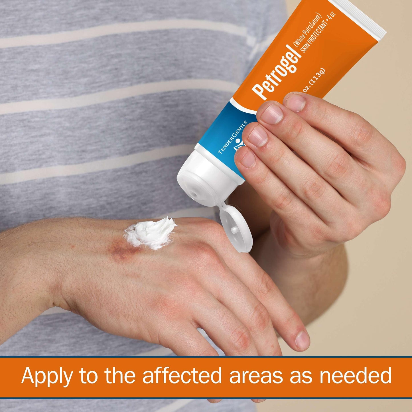 White Petroleum Jelly Squeeze Tube - 4 oz of Petrolatum for Minor Wounds and Diaper Rashes - Good for Chapped Lips from Dry Weather