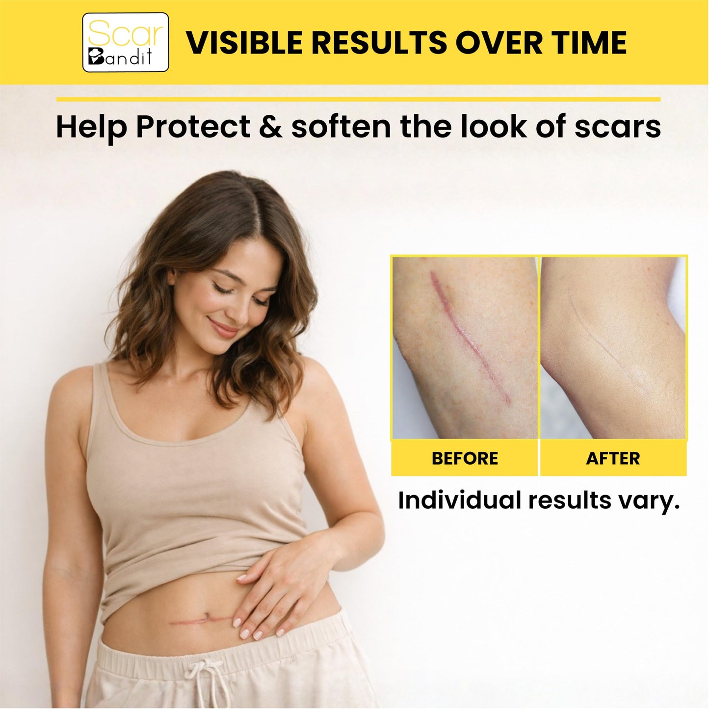 Scar Bandit Silicone Scar Sheets for C-Section & Surgical Scars – Silicone Scar Tape for C-Section Recovery After Birth, Tummy Tuck & Surgery – Flexible Scar Sheets for Keloid & Scar Care - 4 pcs